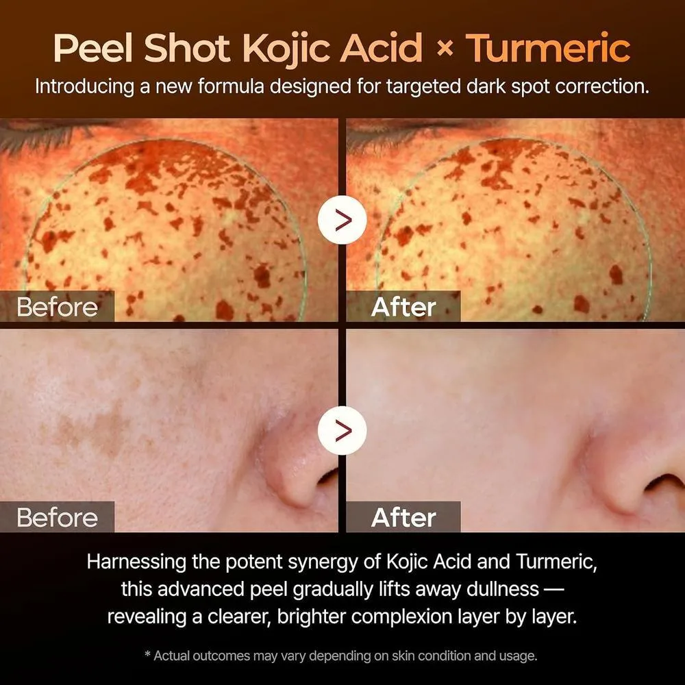 Suero Dr.Melaxin Exfoliante Ácido Kójico Y Cúrcuma 80ml Piel Radiante Y Corrección De Manchas