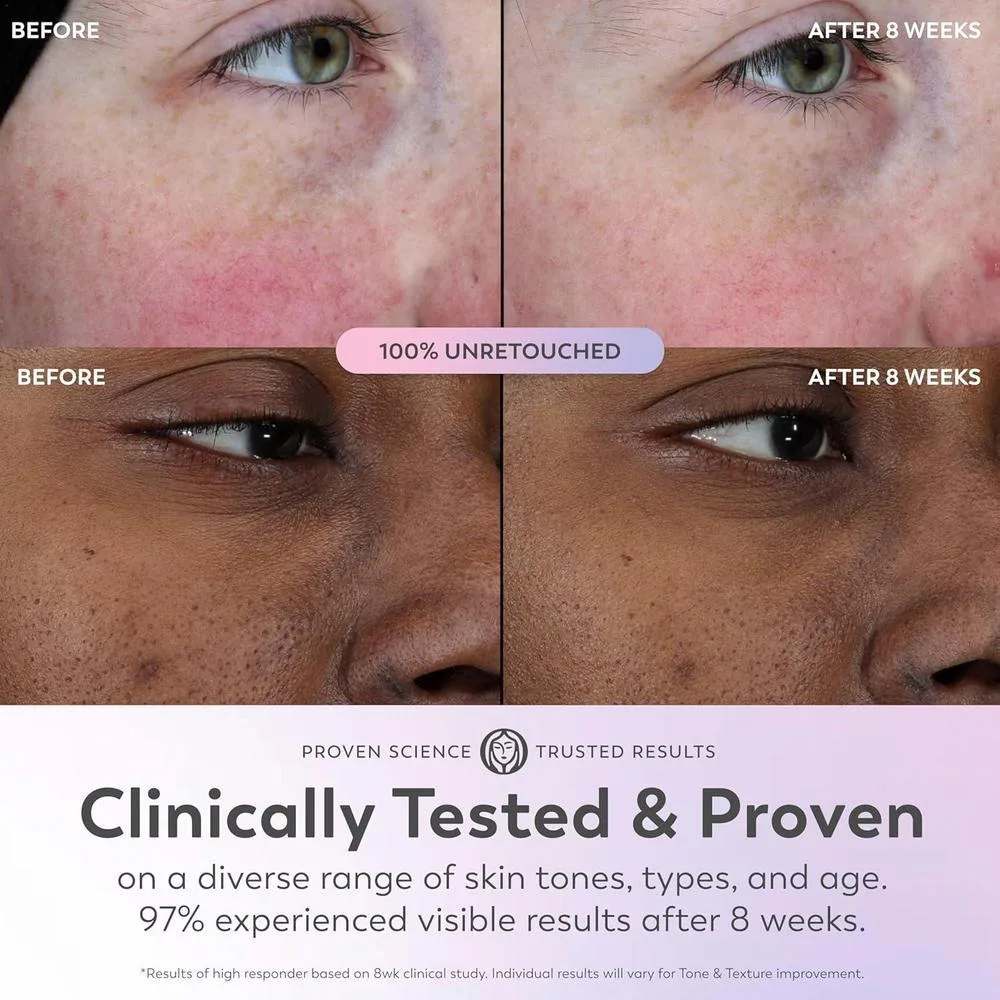 Olay Serum Niacinamida Vitamina C E Colágeno AHA 5 Benef. 30ml