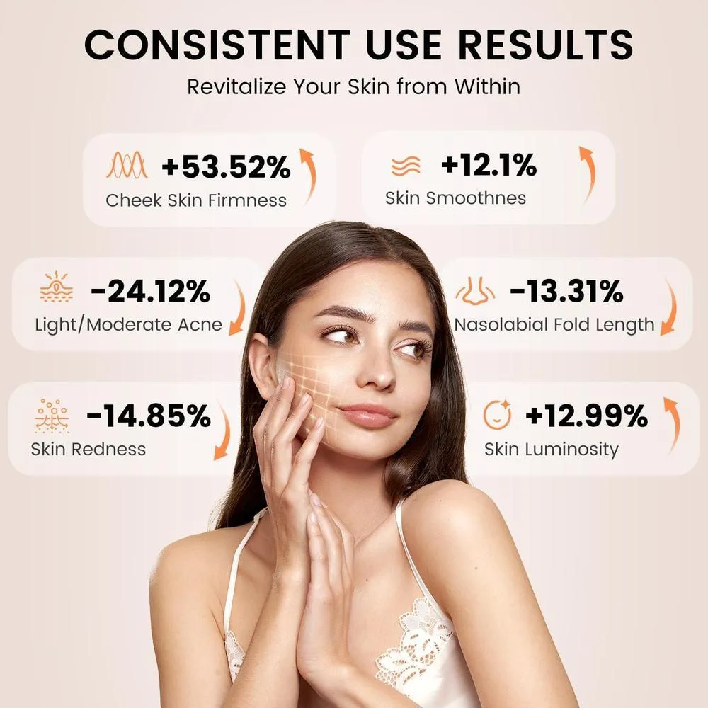 Máscara facial LED Avorla terapia de luz roja portátil recargable con 4 modos e infrarroja, 216 LED luz para piel radiante
