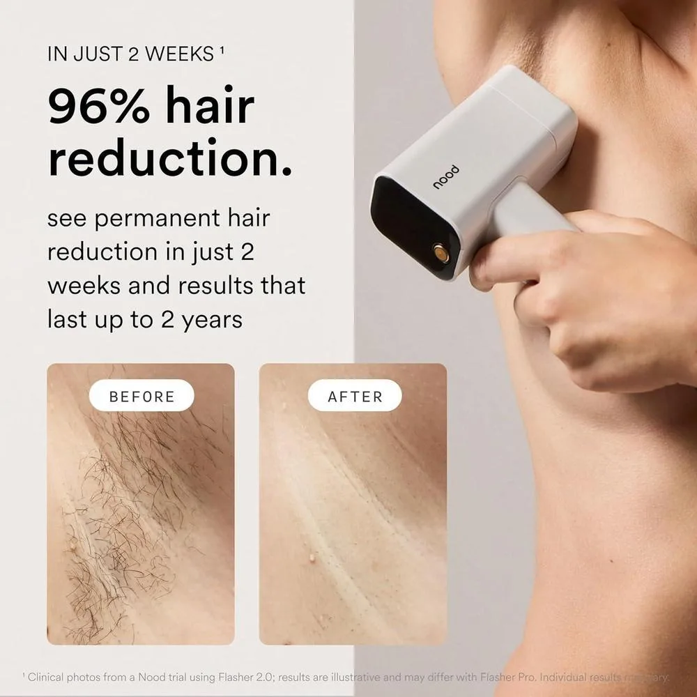 Nood Flasher Pro - Dispositivo IPL para depilación láser y terapia anti-edad con luz roja, sin dolor para hombres y mujeres