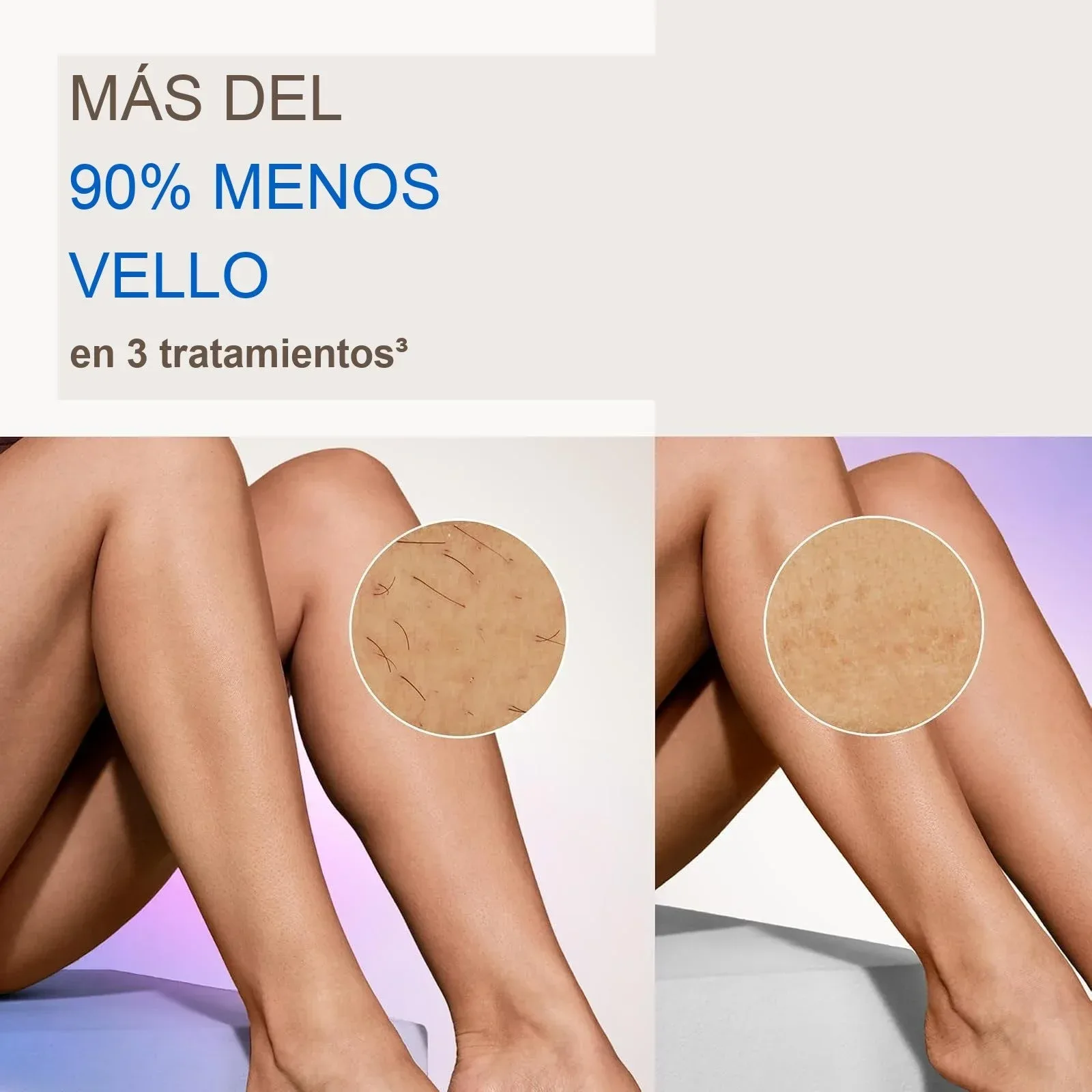 Menos vello desde el segundo tratamiento