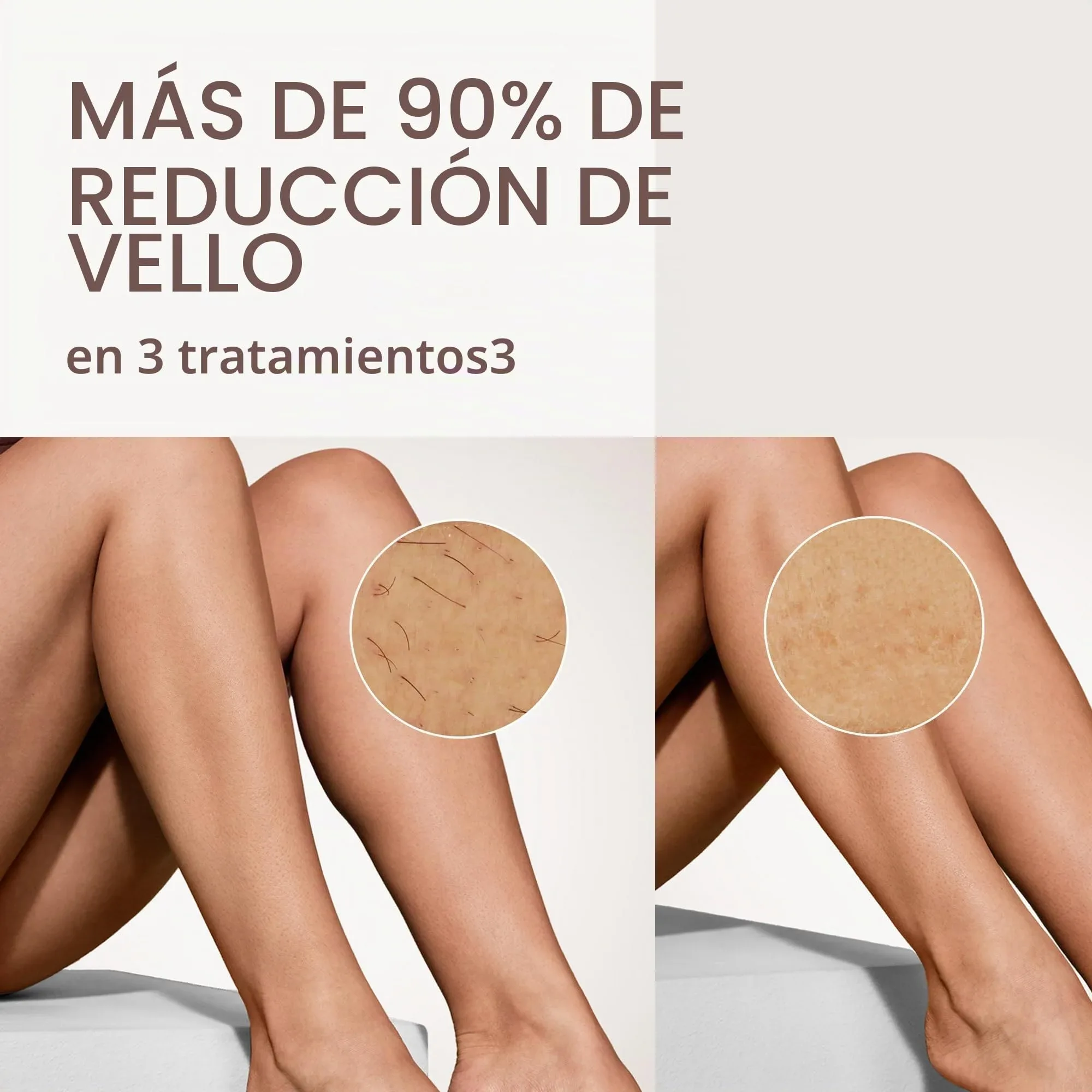 Más del 90 % de reducción del vello en 3 tratamientos